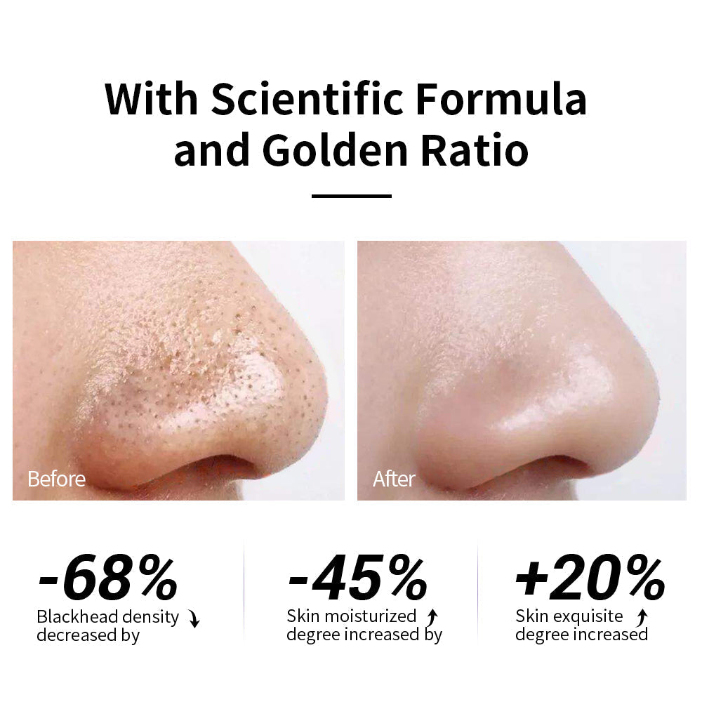 PorePull™ Blackhead Peel Mask